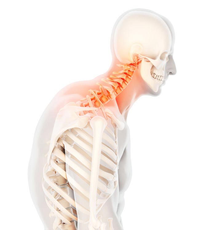Neck-pain-Are-you-affected