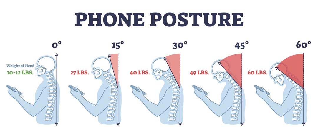 How Chiropractic Care is Combatting the Tech Neck Epidemic